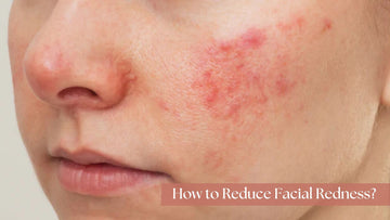 10 Causes You Have Skin Facial Redness & How to Reduce It by Club Derma