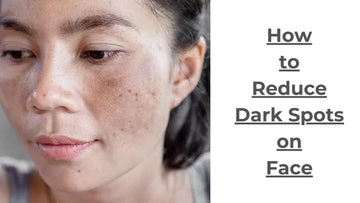 How to Reduce, Remove or Prevent Dark Spots on Face - CLUB DERMA