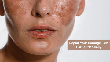 How to Repair Your Damage Skin Barrier Naturally - CLUB DERMA