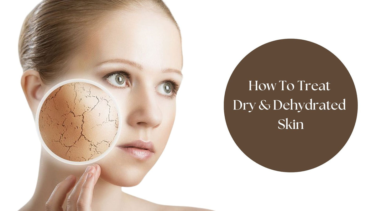 How to Treat Dry and Dehydrated Skin in the Right Way