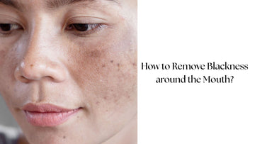 How to Remove Blackness around the Mouth by Club Derma